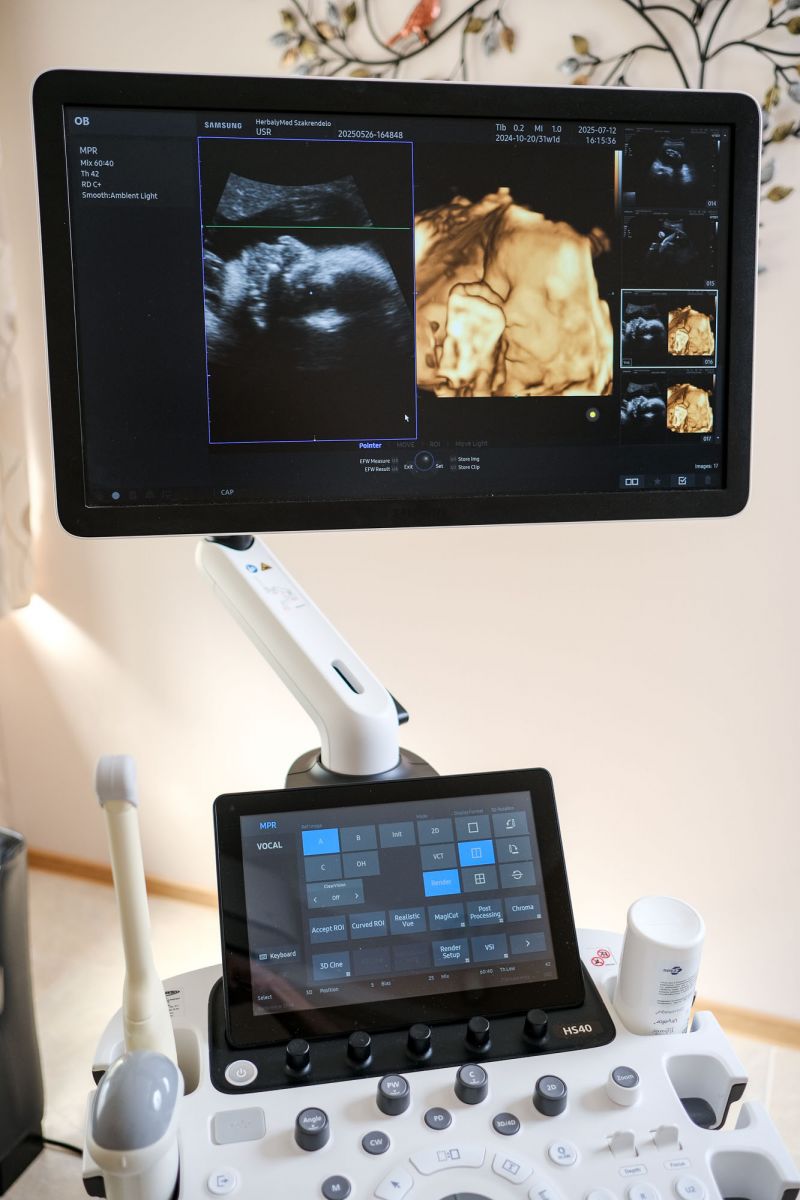 Használt HS40 ultrahang készülék 3D/4D/5D hasi + 2D nőgyógyászati vizsgálófejjel Használt HS40 ultrahang készülék 3D/4D/5D hasi + 2D nőgyógyászati vizsgálófejjel