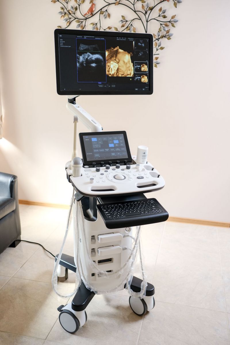 Használt HS40 ultrahang készülék 3D/4D/5D hasi + 2D nőgyógyászati vizsgálófejjel Használt HS40 ultrahang készülék 3D/4D/5D hasi + 2D nőgyógyászati vizsgálófejjel