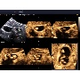 Accuvix A30 - OVIX kép