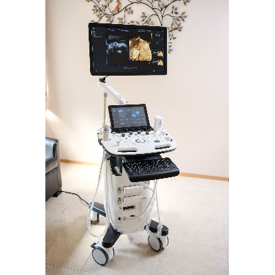 Használt HS40 ultrahang készülék 3D/4D/5D hasi vizsgálófejjel - Eladó használt Samsung Medison HS40 ultrahang készülék két vizsgálófejjel